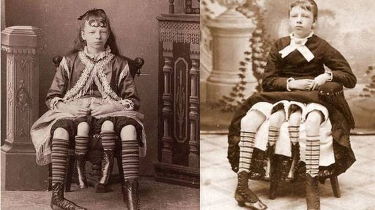 Josephine Myrtle Corbin, trabak gainditu zituen lau hankako emakumea